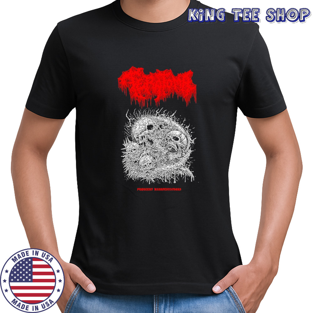 Teratoma Manifestations T-shirt